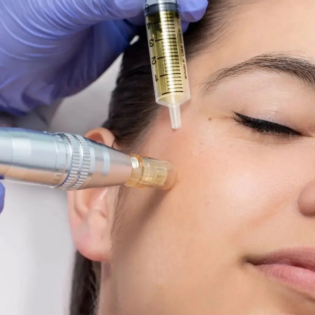 микронидлинг